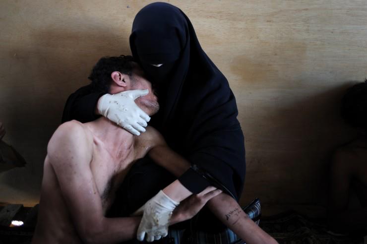 Zdjcie przedstawia kobiet trzymajc w swoich ramionach rannego krewnego.Wykonane zostao w meczecie zaadoptowanym na szpital polowy przez demonstrantów protestujcych przeciwko rzdom Ali Abdullah Saleh.