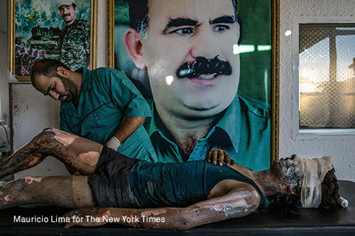 © Mauricio Lima - IS Fighter Treated at Kurdish Hospital