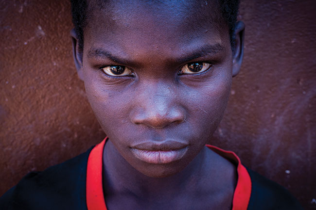 Guchoniemy chopiec mieszkajcy w orodku dla dzieci obcionych albinizmem. Mieszka tam te sporo dzieci z zaburzeniami suchu i wzroku. Tanzania, 2014. Fotografia cyfrowa, Sony A900, 50 mm f/1,4.