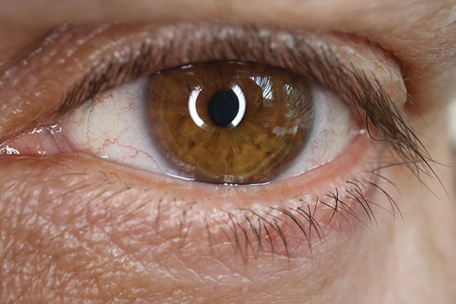 Zdjcie selfie oka wykonane za pomoc obiektywu makro 28 mm z wczonymi lampkami diodowymi w przedniej czci obiektywu.